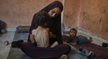 Gaza’s Children Ravaged by Severe Hunger, Their Cries Now Silent